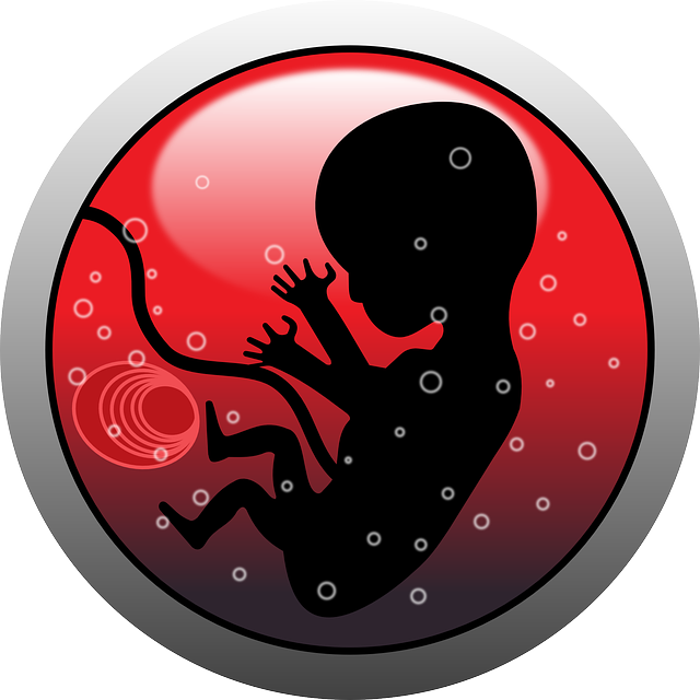 FETUS IN FETU: FETUS TRAPPED WITHIN FETUS